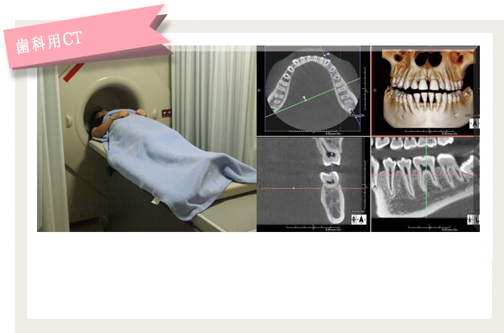 歯科用CT