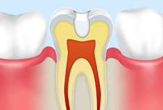 予防歯科イメージ